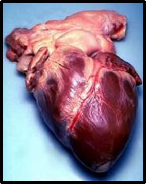 image of a human heart