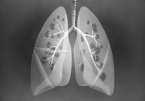 Image of the lungs infected with tuberculosis