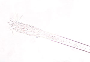 A microscopic picture of the root of a cat hair. The root looks like it is made of little hairs or quills.