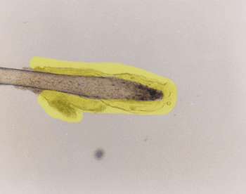 A hair follicle in the catagen stage; the follicular tag is wrapped around the root of the hair and goes a little ways up the body of the hair. The follicular tag is highlighted in yellow.
