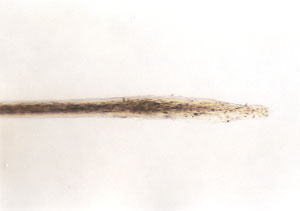 A microscopic picture of the root of a dog hair. The root is pointy like a nail.