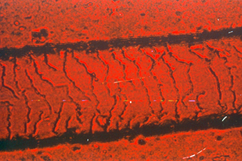 scale mount showing the cuticle pattern of a strand of human hair