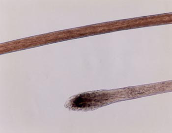 Two hairs, one showing a rounded, club-shaped root and the other showing the middle portion of a hair, which is flat-bordered with no visible spikes or crown protrusions.