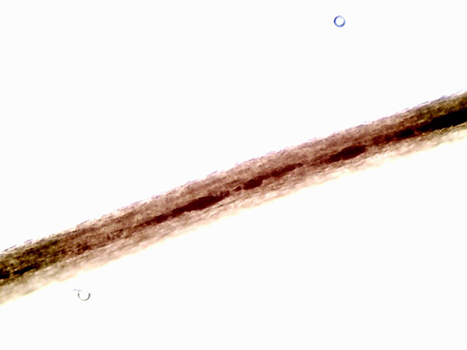 Kate Krebs's hair sample at 10x magnification. The hair has a dark, reddish-brown cortex and a fragmented medulla.