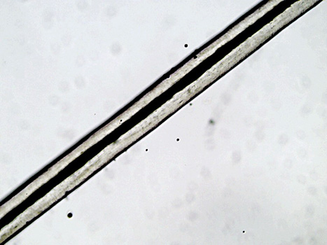 Sarah Smith's hair sample at 10x magnification. The medulla is continuous and dark, almost black. The cuticle is also dark.