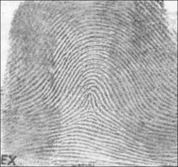 fingerprint with ridges that enter on one side and exit on the other, rising sharply like a tent