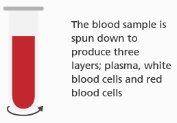 A blood sample. Text reads: 'The blood sample is spun down to produce three layers; plasma, white blood cells and red blood cells.'