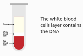 The blood sample is now separated into plasma, white blood cells, and red blood cells. Text reads: 'The white blood cells layer contains the DNA.'