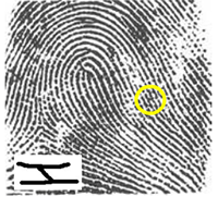 Fingerprint with a highlighted bridge and magnified inset of bridge pattern. 