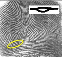 Fingerprint with a highlighted encloser and magnified inset of encloser pattern. 