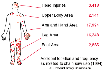 Accident location and frequency as related to chain saw use (1994): head injuries 3,418; upper body area 2,141; arm and hand area 17,994; leg area 16,348; foot area 2,885