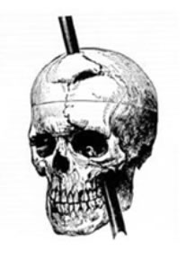 "Side view sketch of Phineas' skull with the rod"