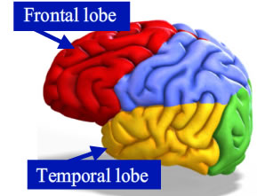 "Diagram of the brain, pointing to the frontal lobe and the temporal lobe described in the content"